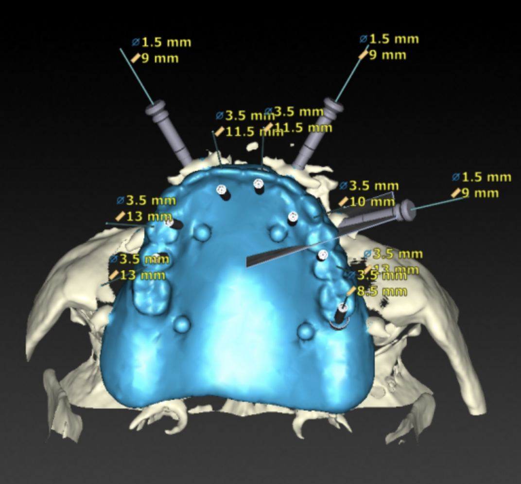 How Our Technology Helps You - NC Prosthodontic Specialists